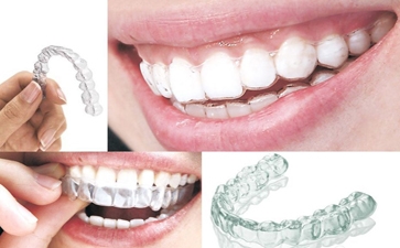 石家庄隐形矫正多少钱