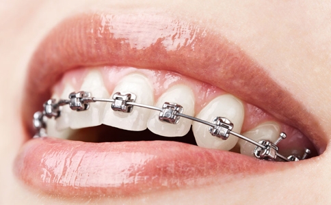 石家庄牙齿矫正在什么年龄做