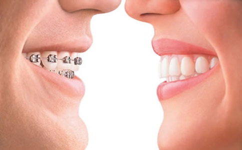 石家庄牙齿矫正后多久可以恢复