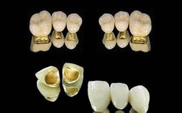 石家庄烤瓷牙是什么