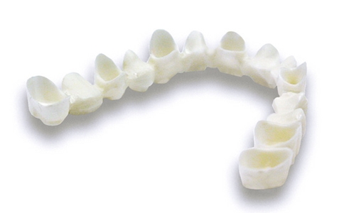 石家庄烤瓷牙可以使用多长时间