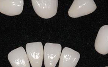 石家庄瓷贴面哪家医院好