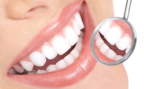 种植牙要怎么维护