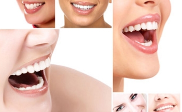 牙齿难看 怎么矫正