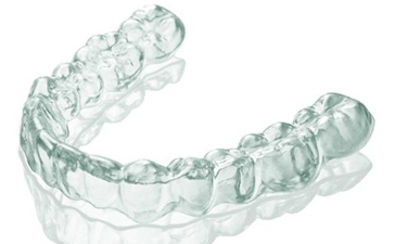 石家庄隐形牙套价格贵不贵