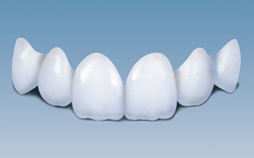 烤瓷牙的种类及区别